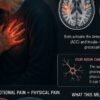 Why Breakups Feel Physical The Brain